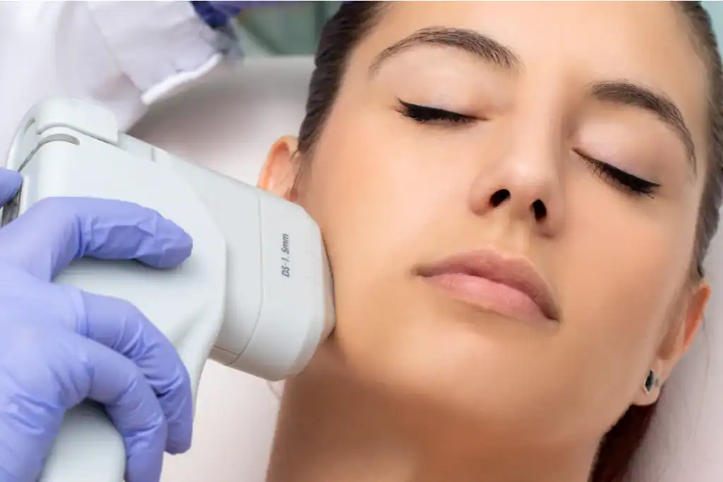 Discover the Perfect Duo: RF Microneedling and HIFU 2 Image of Morpheus8 And HIFU Combined with Lipo 360 Maidstone